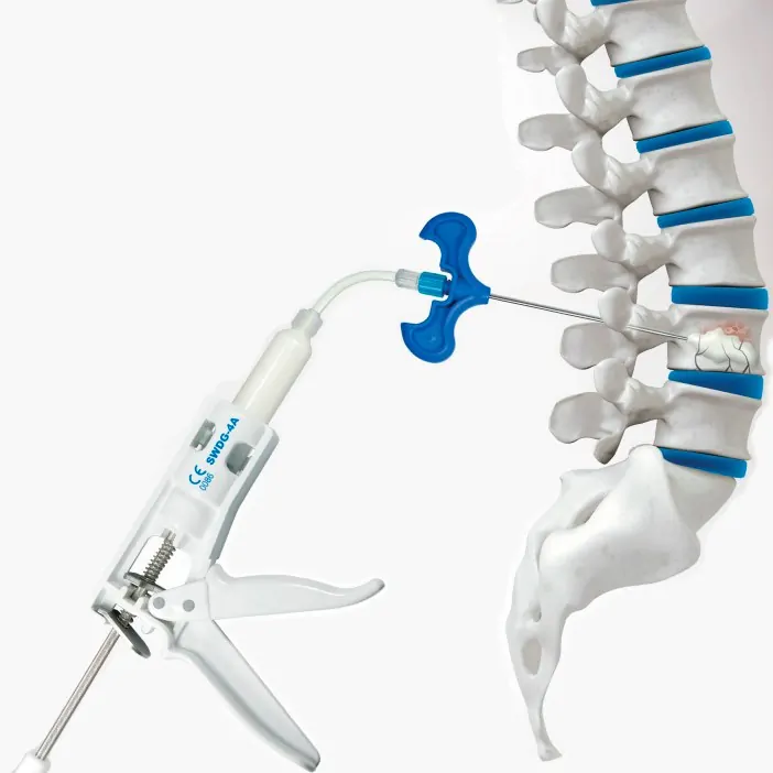 Vertebroplastía